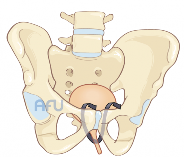 Incontinence – Descente d’organes | Hôpital Saint Louis