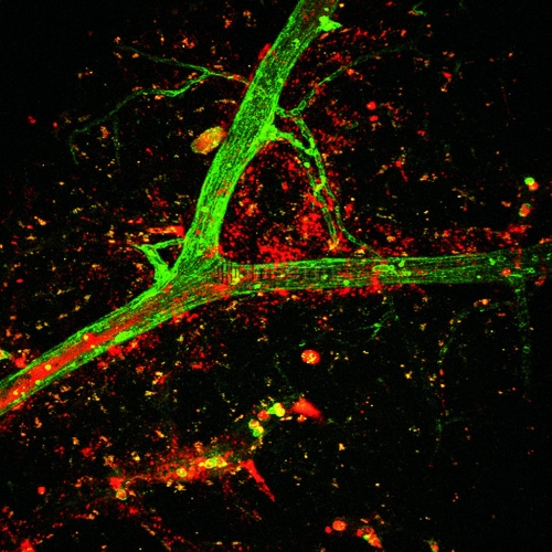 Accident vasculaire cérébral (AVC) Visualisation du tPA Activateur tissulaire du Plasminogène en rouge dans un vaisseau (en vert)